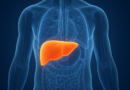 Gordura no fígado: a nova epidemia silenciosa que ameaça milhões de brasileiros e pode evoluir para cirrose e câncer, alerta especialista